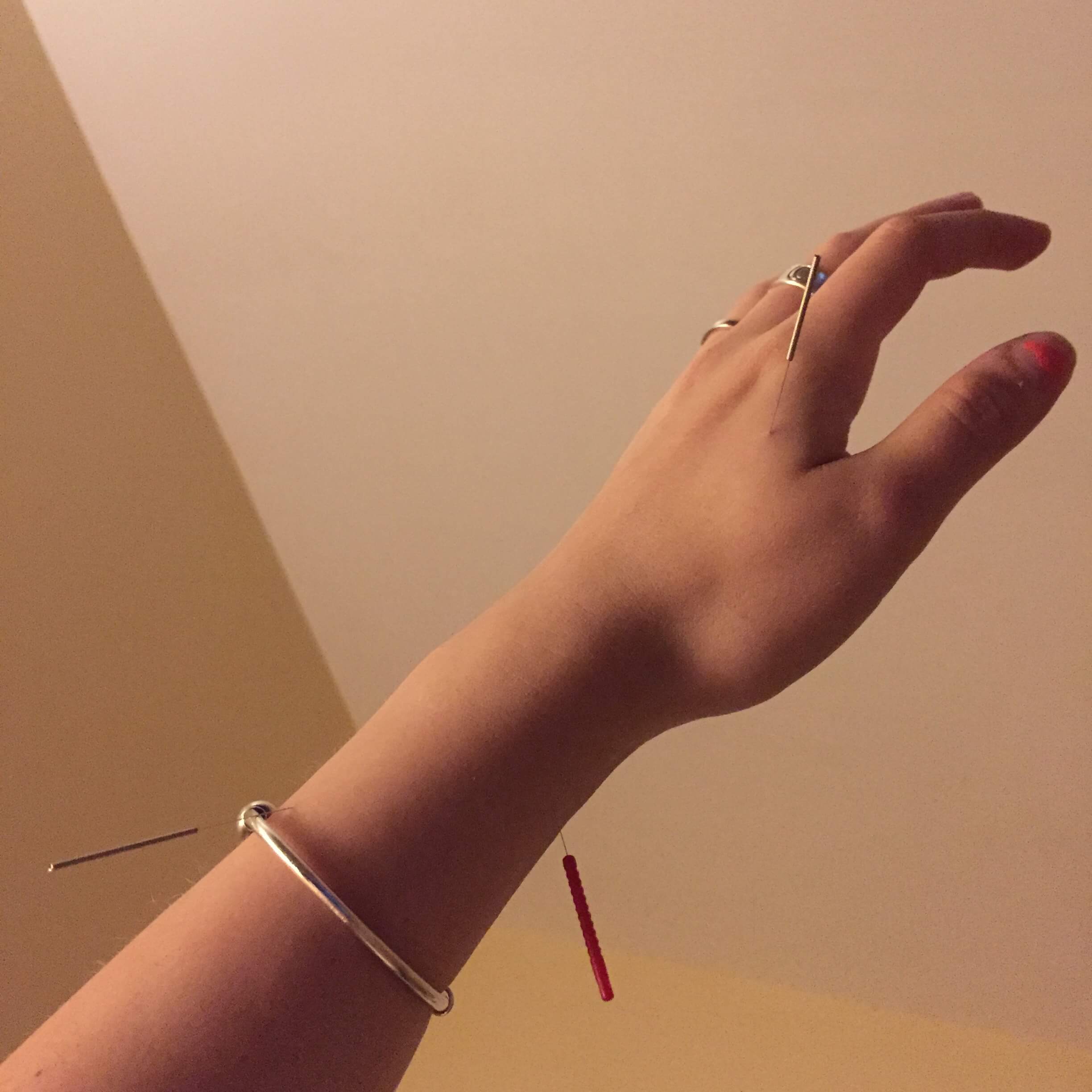 acupuncture needles in hand